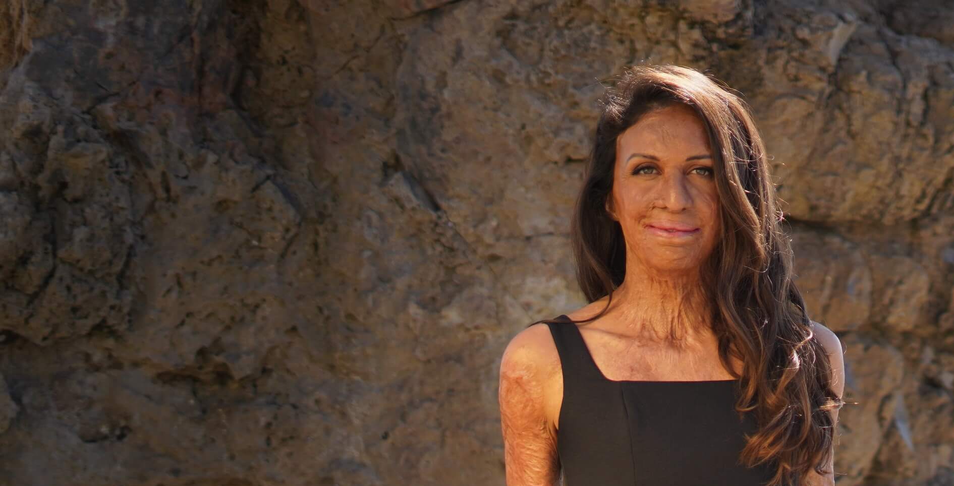 Adversity & Activating Your Full Potential With Turia Pitt